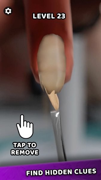 法医大师游戏无广告图3