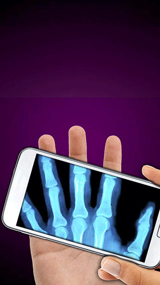 X射线模拟器图2