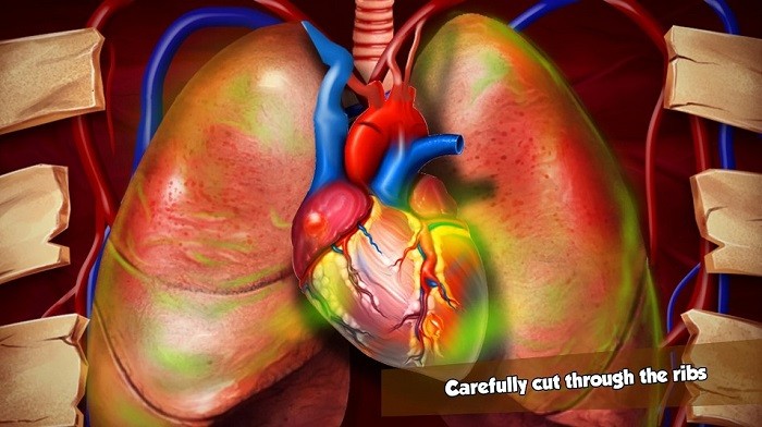 心脏手术游戏安卓免费版图3