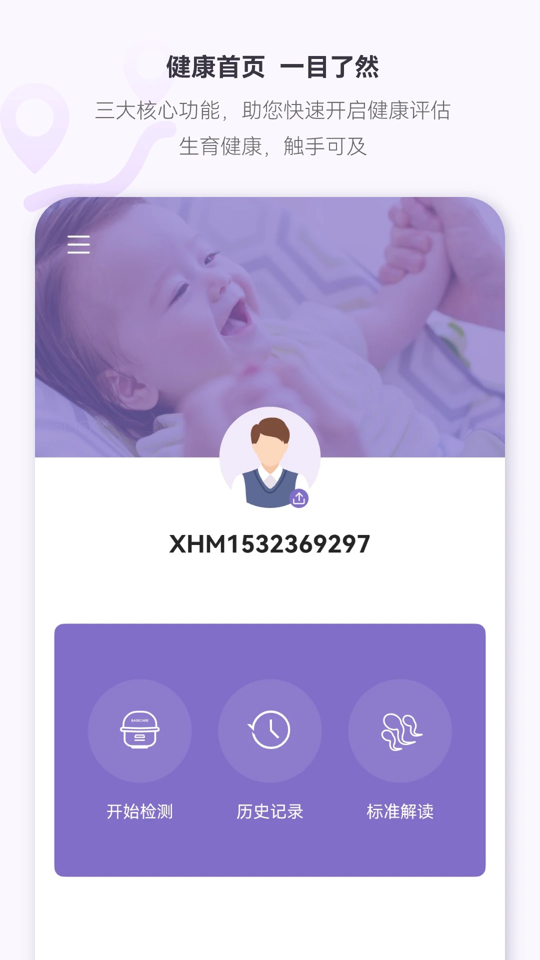 便携式精子质量分析仪图1